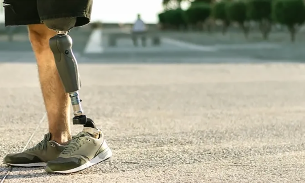 Microminiature Solutions for Prosthetic Applications